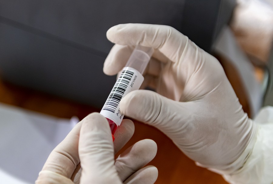 Chefe do Partido em Ruili é afastado do cargo por negligência no controle da COVID-19